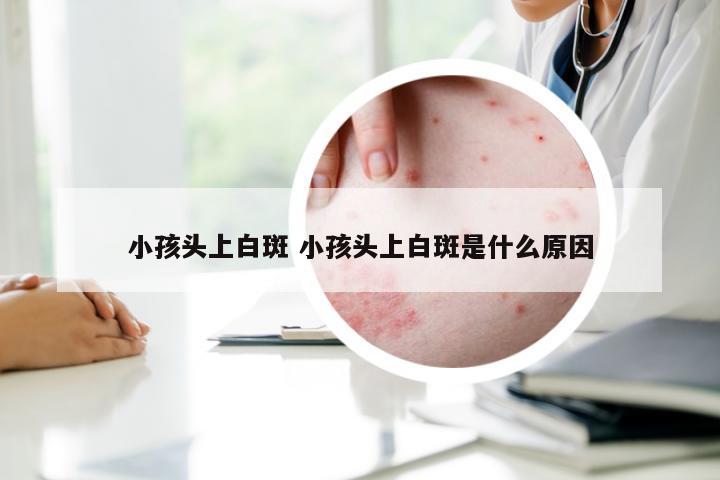 小孩头上白斑 小孩头上白斑是什么原因