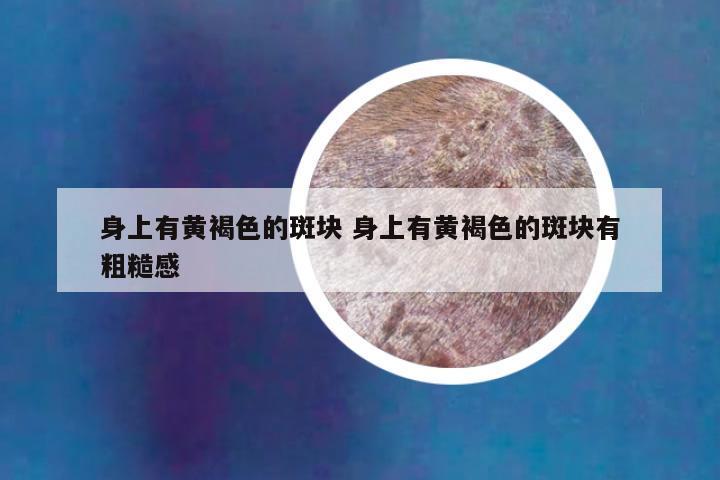 身上有黄褐色的斑块 身上有黄褐色的斑块有粗糙感