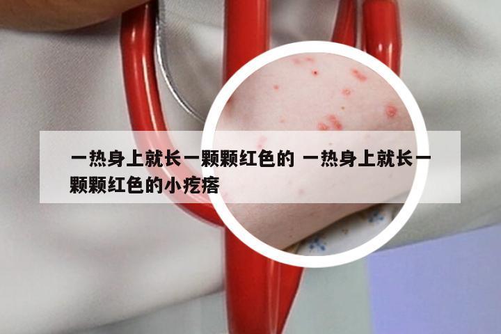 一热身上就长一颗颗红色的 一热身上就长一颗颗红色的小疙瘩