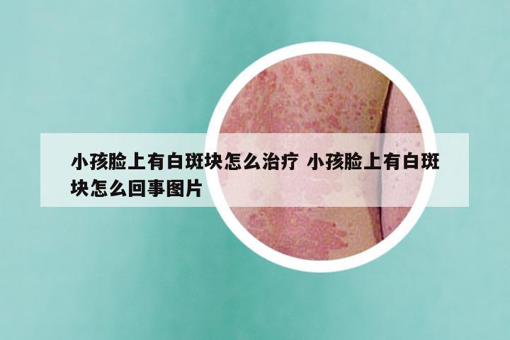 小孩脸上有白斑块怎么治疗 小孩脸上有白斑块怎么回事图片