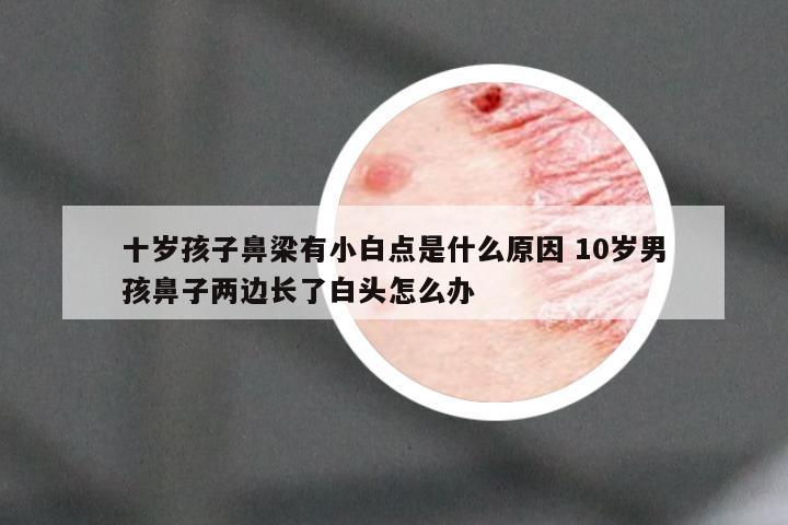 十岁孩子鼻梁有小白点是什么原因 10岁男孩鼻子两边长了白头怎么办
