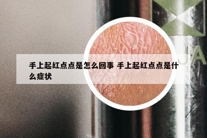 手上起红点点是怎么回事 手上起红点点是什么症状