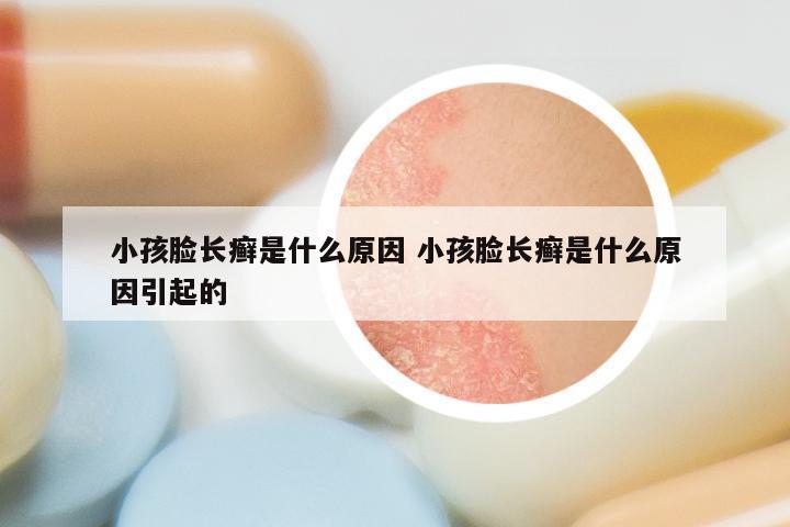 小孩脸长癣是什么原因 小孩脸长癣是什么原因引起的
