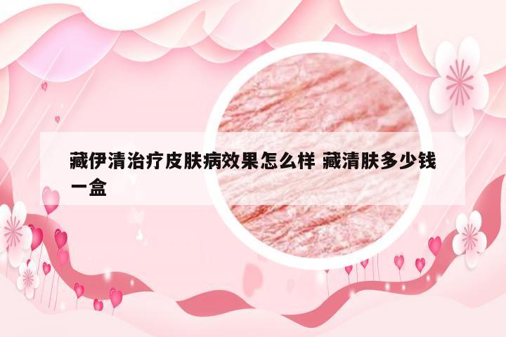 藏伊清治疗皮肤病效果怎么样 藏清肤多少钱一盒
