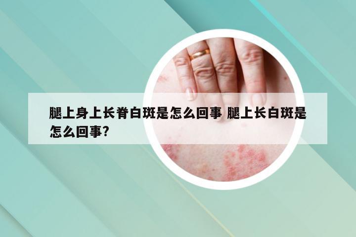 腿上身上长脊白斑是怎么回事 腿上长白斑是怎么回事?