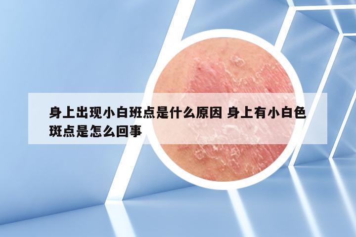 身上出现小白班点是什么原因 身上有小白色斑点是怎么回事