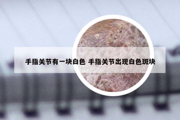 手指关节有一块白色 手指关节出现白色斑块