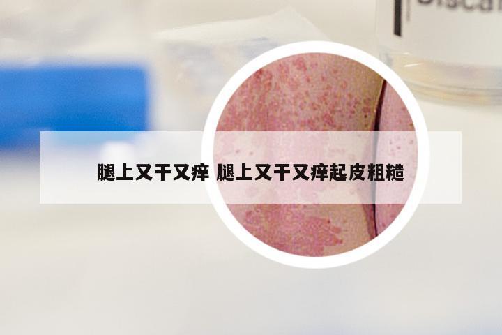 腿上又干又痒 腿上又干又痒起皮粗糙