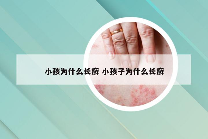 小孩为什么长癣 小孩子为什么长癣