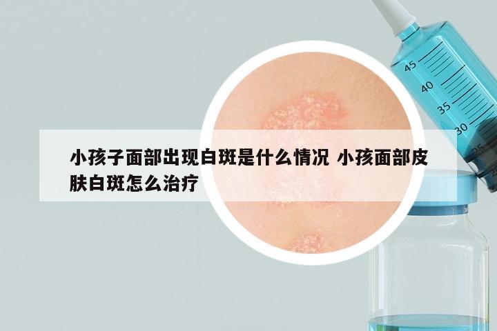 小孩子面部出现白斑是什么情况 小孩面部皮肤白斑怎么治疗