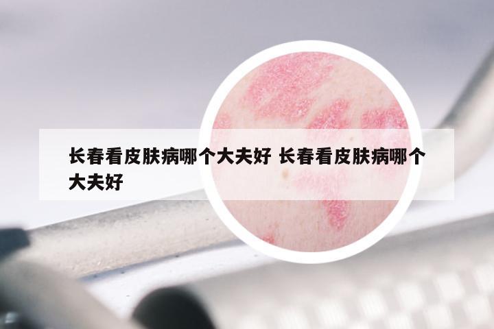 长春看皮肤病哪个大夫好 长春看皮肤病哪个大夫好
