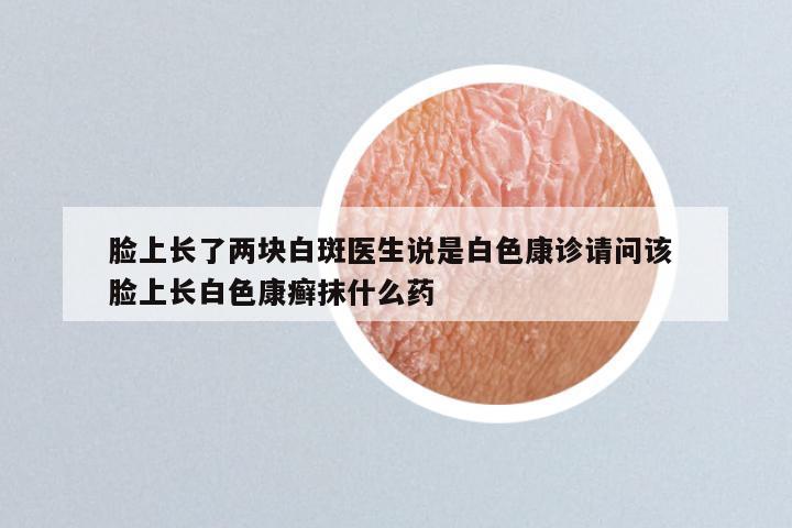 脸上长了两块白斑医生说是白色康诊请问该 脸上长白色康癣抹什么药