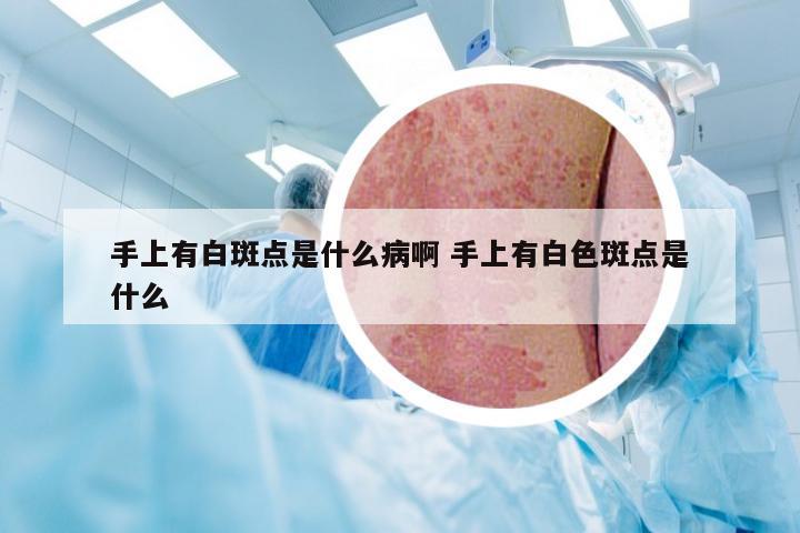 手上有白斑点是什么病啊 手上有白色斑点是什么