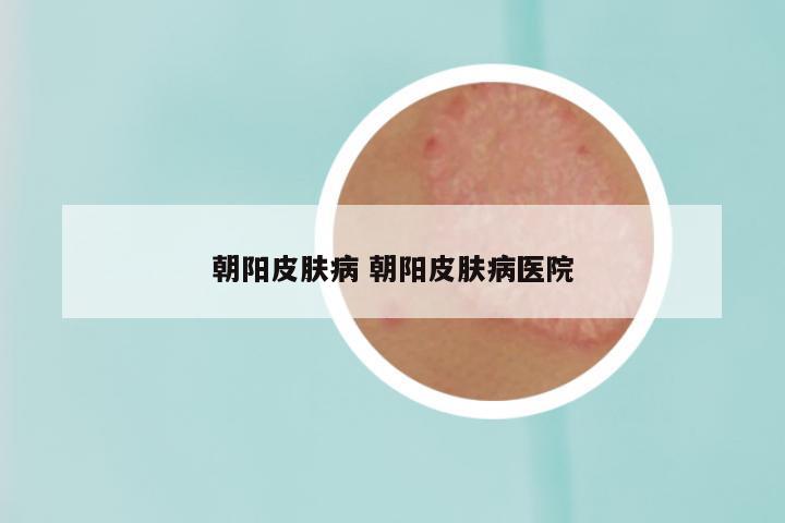 朝阳皮肤病 朝阳皮肤病医院