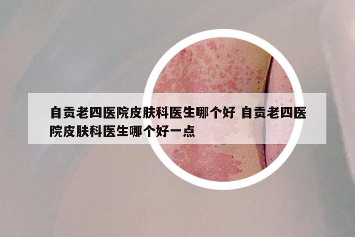 自贡老四医院皮肤科医生哪个好 自贡老四医院皮肤科医生哪个好一点