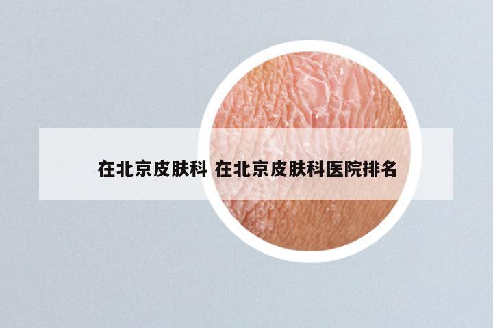在北京皮肤科 在北京皮肤科医院排名