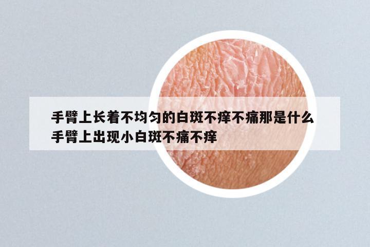 手臂上长着不均匀的白斑不痒不痛那是什么 手臂上出现小白斑不痛不痒
