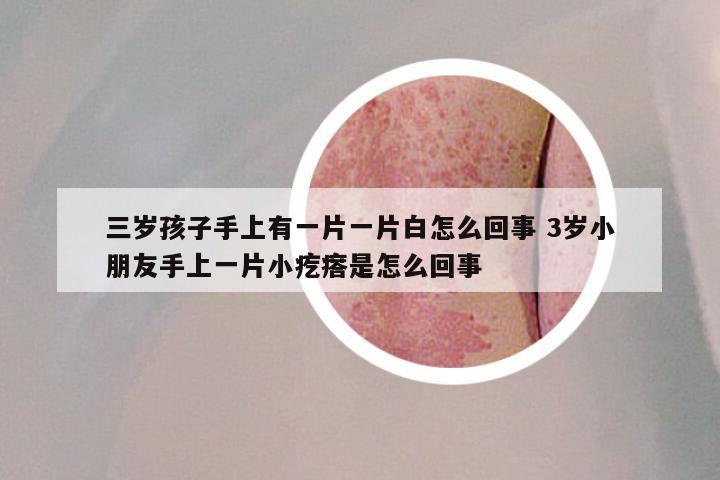 三岁孩子手上有一片一片白怎么回事 3岁小朋友手上一片小疙瘩是怎么回事