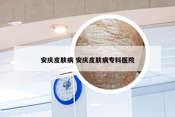 安庆皮肤病 安庆皮肤病专科医院