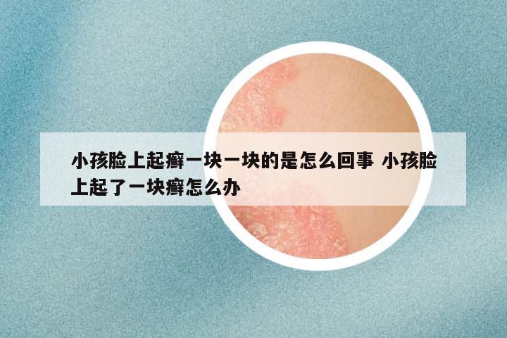 小孩脸上起癣一块一块的是怎么回事 小孩脸上起了一块癣怎么办
