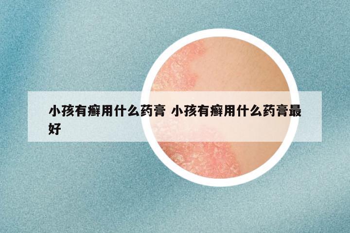 小孩有癣用什么药膏 小孩有癣用什么药膏最好