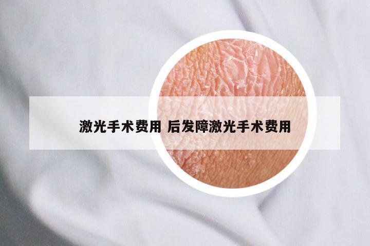 激光手术费用 后发障激光手术费用