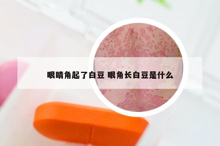 眼睛角起了白豆 眼角长白豆是什么