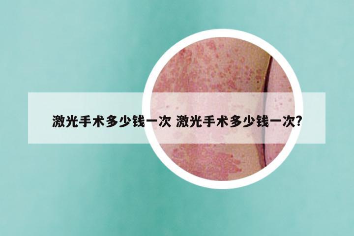 激光手术多少钱一次 激光手术多少钱一次?