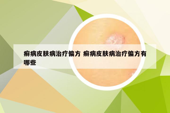 癣病皮肤病治疗偏方 癣病皮肤病治疗偏方有哪些