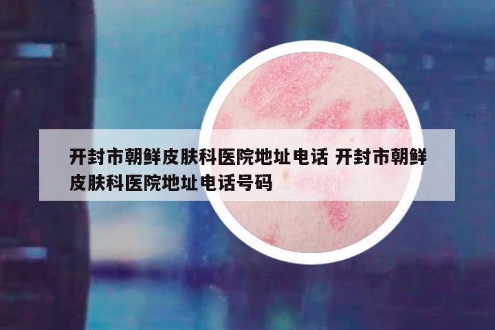 开封市朝鲜皮肤科医院地址电话 开封市朝鲜皮肤科医院地址电话号码