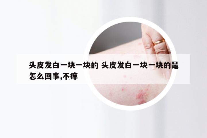 头皮发白一块一块的 头皮发白一块一块的是怎么回事,不痒