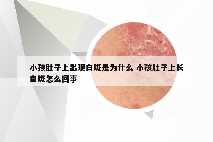 小孩肚子上出现白斑是为什么 小孩肚子上长白斑怎么回事