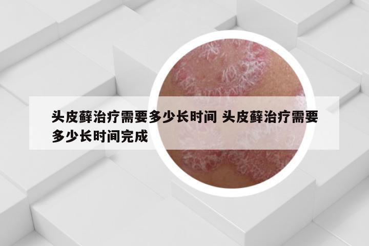 头皮藓治疗需要多少长时间 头皮藓治疗需要多少长时间完成