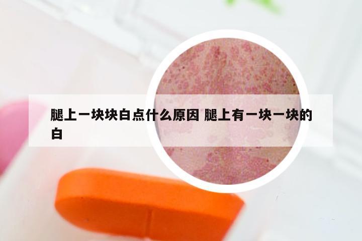 腿上一块块白点什么原因 腿上有一块一块的白
