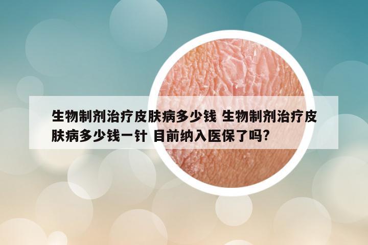 生物制剂治疗皮肤病多少钱 生物制剂治疗皮肤病多少钱一针 目前纳入医保了吗?
