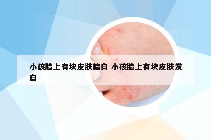 小孩脸上有块皮肤偏白 小孩脸上有块皮肤发白