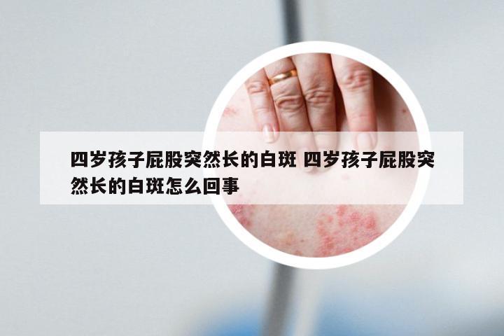四岁孩子屁股突然长的白斑 四岁孩子屁股突然长的白斑怎么回事