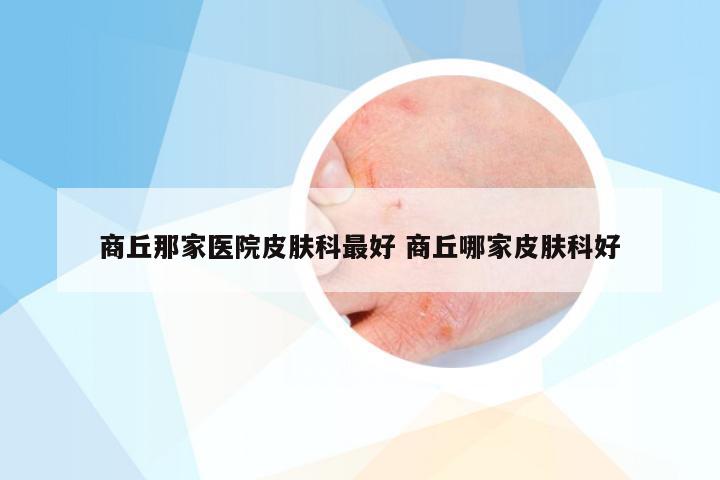 商丘那家医院皮肤科最好 商丘哪家皮肤科好