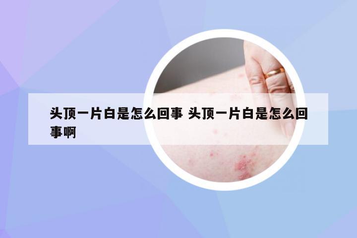 头顶一片白是怎么回事 头顶一片白是怎么回事啊