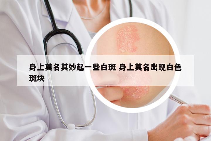 身上莫名其妙起一些白斑 身上莫名出现白色斑块