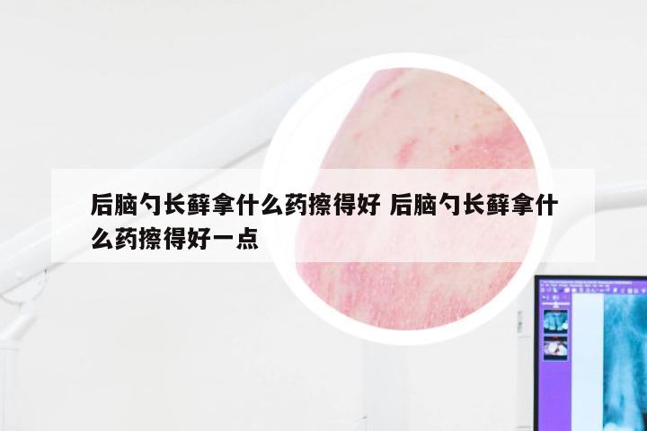 后脑勺长藓拿什么药擦得好 后脑勺长藓拿什么药擦得好一点