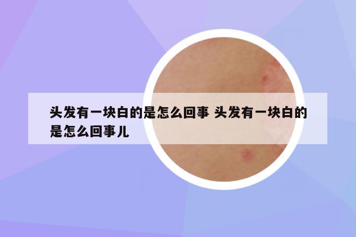 头发有一块白的是怎么回事 头发有一块白的是怎么回事儿