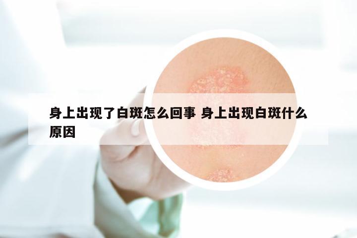 身上出现了白斑怎么回事 身上出现白斑什么原因