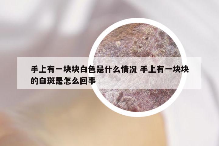 手上有一块块白色是什么情况 手上有一块块的白斑是怎么回事