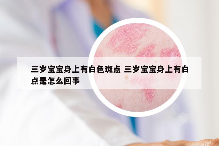 三岁宝宝身上有白色斑点 三岁宝宝身上有白点是怎么回事