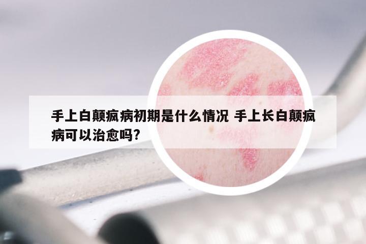 手上白颠疯病初期是什么情况 手上长白颠疯病可以治愈吗?