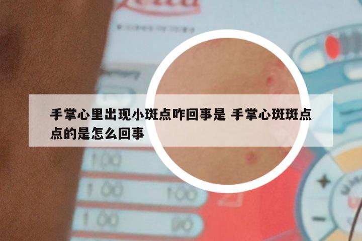 手掌心里出现小斑点咋回事是 手掌心斑斑点点的是怎么回事