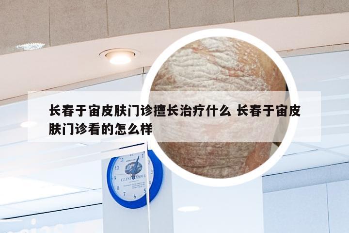 长春于宙皮肤门诊擅长治疗什么 长春于宙皮肤门诊看的怎么样