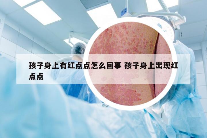 孩子身上有红点点怎么回事 孩子身上出现红点点