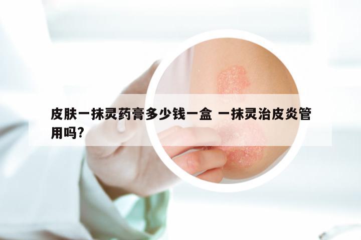 皮肤一抹灵药膏多少钱一盒 一抹灵治皮炎管用吗?
